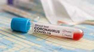 Pakar Epidemiologi Ungkap 3 Kunci Sukses Kendalikan Corona COVID-19