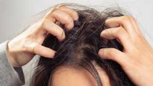 7 Penyakit yang Bisa Ditandai dengan Kulit Kepala Gatal