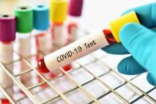 BPPT Dorong Percepatan Pengembangan Vaksin Corona Buatan Dalam Negeri