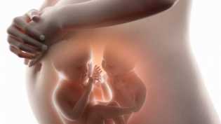 Mengenal 8 Jenis Bayi Kembar Siam dan Ciri-cirinya yang Jarang Diketahui