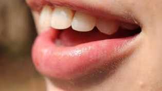 Tips Menjaga Kesehatan Gigi di Masa Pademi Covid-19