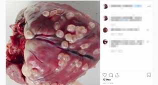 Viral Foto Jantung Penuh Cacing Akibat Makan Daging Babi Belum Matang