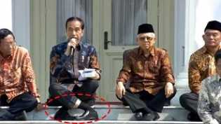 Dikaitkan dengan Posisi Duduk Jokowi yang Viral, Apa Itu Hyperlaxity?