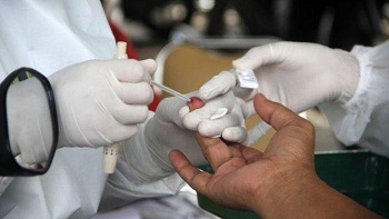 Rapid Test, Bisnis di Tengah Pandemi