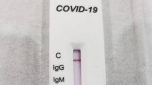 Apa itu Rapid Test & Berapa Biaya Tes Covid-19