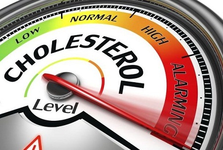 Adakah Ciri-ciri Kolesterol TinggiPada Tubuh?