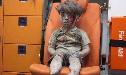Bukan Boneka, Bocah Suriah di Dalam Ambulans Menyedihkan