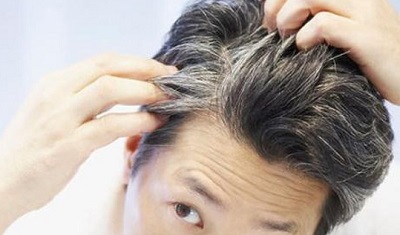 Sebab Rambut Mendadak Beruban