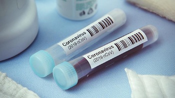 Peneliti Sebut Virus Corona Bisa Serang Kekebalan Tubuh Seperti HIV
